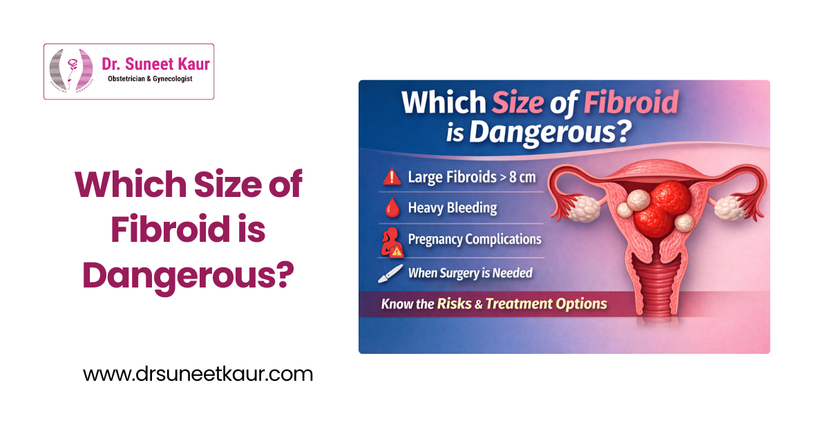 Which Size of Fibroid is Dangerous? Complete Guide for Women
